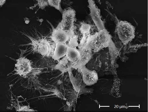 Scanning electron microscopes KYKY EM-8000. Examples of images.