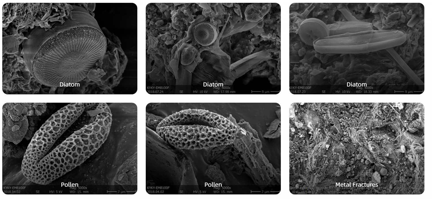 Examples of the use of scanning electron microscopes